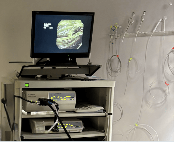 On the left: Endoscopy tower showing blades of grass in a dog’s stomach. On the right: Instruments used for retrieving various inedible objects or taking biopsies of the stomach and intestines. 