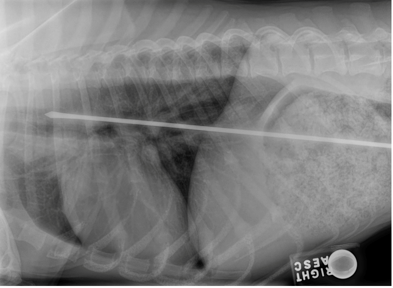 X-Ray: BBQ skewer spanning from the esophagus to the stomach